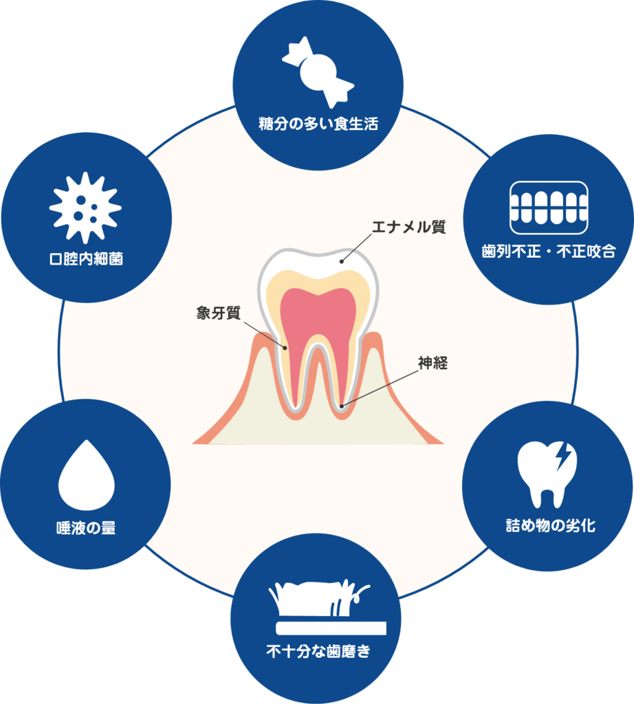 虫歯の出来る原因
