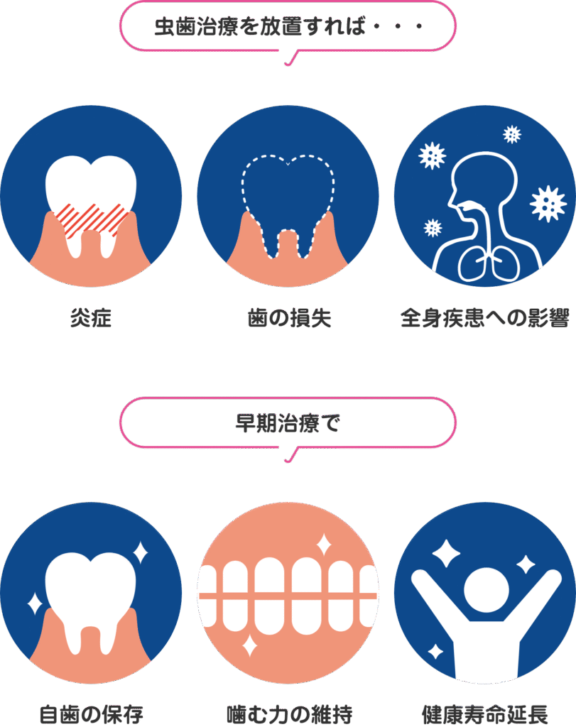 根幹治療の必要性