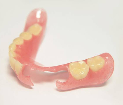 ノンスクラブ義歯